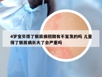 4岁宝贝得了银屑病初期有不复发的吗 儿童得了银屑病长大了会严重吗