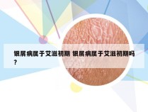 银屑病属于艾滋初期 银屑病属于艾滋初期吗?