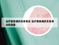 治疗银屑病抗生素用法 治疗银屑病抗生素用法和用量