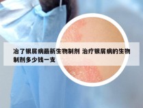冶了银屑病最新生物制剂 治疗银屑病的生物制剂多少钱一支