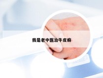 我是老中医治牛皮癣