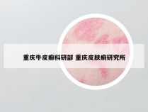 重庆牛皮癣科研部 重庆皮肤癣研究所