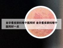 金华看皮肤科哪个医院好 金华看皮肤科哪个医院好一点