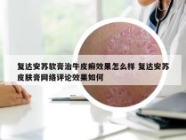 复达安苏软膏治牛皮癣效果怎么样 复达安苏皮肤膏网络评论效果如何