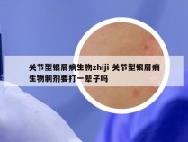 关节型银屑病生物zhiji 关节型银屑病生物制剂要打一辈子吗