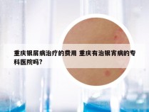 重庆银屑病治疗的费用 重庆有治银宵病的专科医院吗?