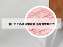 有什么土办法治银霄病 治疗银霄病土方