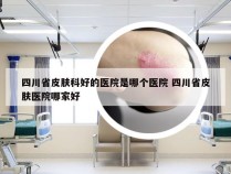 四川省皮肤科好的医院是哪个医院 四川省皮肤医院哪家好