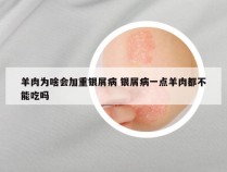 羊肉为啥会加重银屑病 银屑病一点羊肉都不能吃吗
