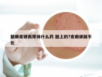 腿癣皮硬而厚抹什么药 腿上的?皮癣顽固不化