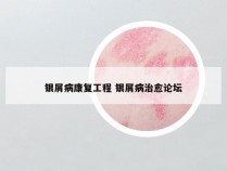 银屑病康复工程 银屑病治愈论坛