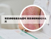 银屑病喉咙痛会加重吗 银屑病咽喉痛吃什么药