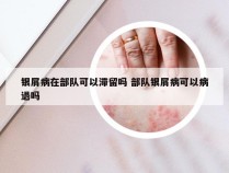 银屑病在部队可以滞留吗 部队银屑病可以病退吗