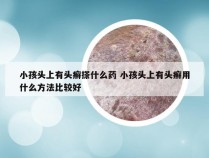 小孩头上有头癣搽什么药 小孩头上有头癣用什么方法比较好