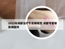 2023年成都治疗牛皮癣研究 成都专看银屑病医院