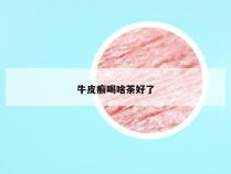 牛皮癣喝啥茶好了