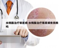 水杨酸治疗银屑病 水杨酸治疗银屑病有依赖吗