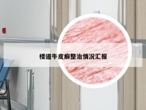 楼道牛皮癣整治情况汇报