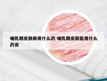 哺乳期皮肤癣用什么药 哺乳期皮藓能用什么药膏