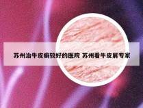 苏州治牛皮癣较好的医院 苏州看牛皮屑专家