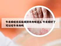 牛皮癣痊愈后能闻到羊肉味道么 牛皮癣好了可以吃牛羊肉吗
