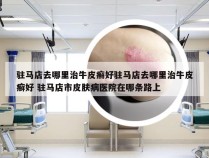 驻马店去哪里治牛皮癣好驻马店去哪里治牛皮癣好 驻马店市皮肤病医院在哪条路上