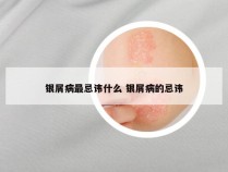 银屑病最忌讳什么 银屑病的忌讳