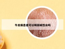 牛皮癣患者可以喝弱碱性水吗