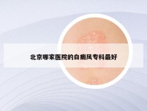 北京哪家医院的白癜风专科最好