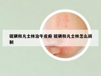 硫磺和凡士林治牛皮癣 硫磺和凡士林怎么调制