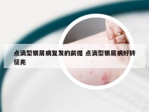 点滴型银屑病复发的前提 点滴型银屑病好转征兆