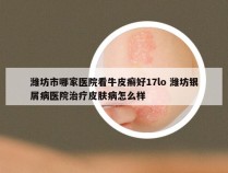 潍坊市哪家医院看牛皮癣好17lo 潍坊银屑病医院治疗皮肤病怎么样