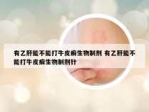 有乙肝能不能打牛皮癣生物制剂 有乙肝能不能打牛皮癣生物制剂针