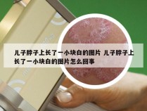儿子脖子上长了一小块白的图片 儿子脖子上长了一小块白的图片怎么回事