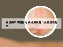 白点癫风早期图片 白点癫风是什么原因引起的