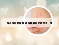 西昌银屑病医院 西昌哪里看皮肤专业一些