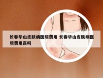 长春华山皮肤病医院费用 长春华山皮肤病医院费用高吗