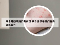 四个月孩子脑门有白斑 四个月孩子脑门有白斑怎么办
