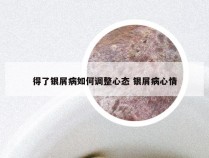 得了银屑病如何调整心态 银屑病心情