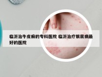 临沂治牛皮癣的专科医院 临沂治疗银屑病最好的医院