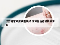 江苏哪家银屑病医院好 江苏省治疗银屑病专家