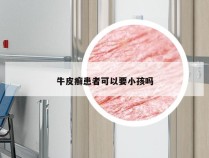 牛皮癣患者可以要小孩吗