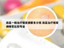 南昌一般治疗银屑病要多少钱 南昌治疗银屑病哪家比较专业