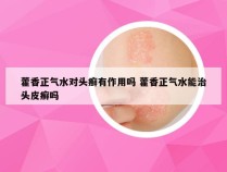 藿香正气水对头癣有作用吗 藿香正气水能治头皮癣吗