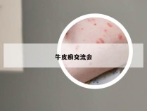 牛皮癣交流会
