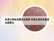 头顶上有白点是怎么回事 头顶上有白点是怎么回事儿