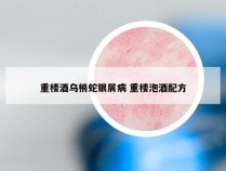 重楼酒乌梢蛇银屑病 重楼泡酒配方