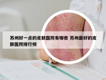 苏州好一点的皮肤医院有哪些 苏州最好的皮肤医院排行榜