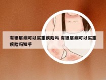 有银屑病可以买重疾险吗 有银屑病可以买重疾险吗知乎