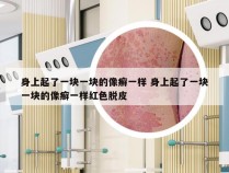 身上起了一块一块的像癣一样 身上起了一块一块的像癣一样红色脱皮